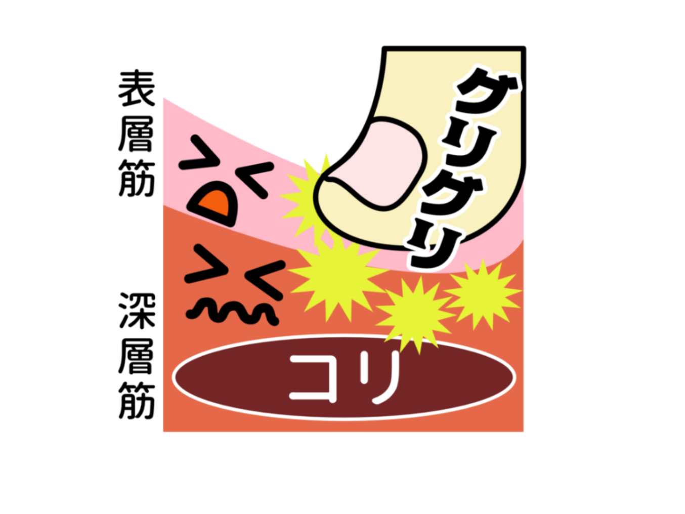 電気鍼・美容鍼と慢性腰痛・ぎっくり腰の効用