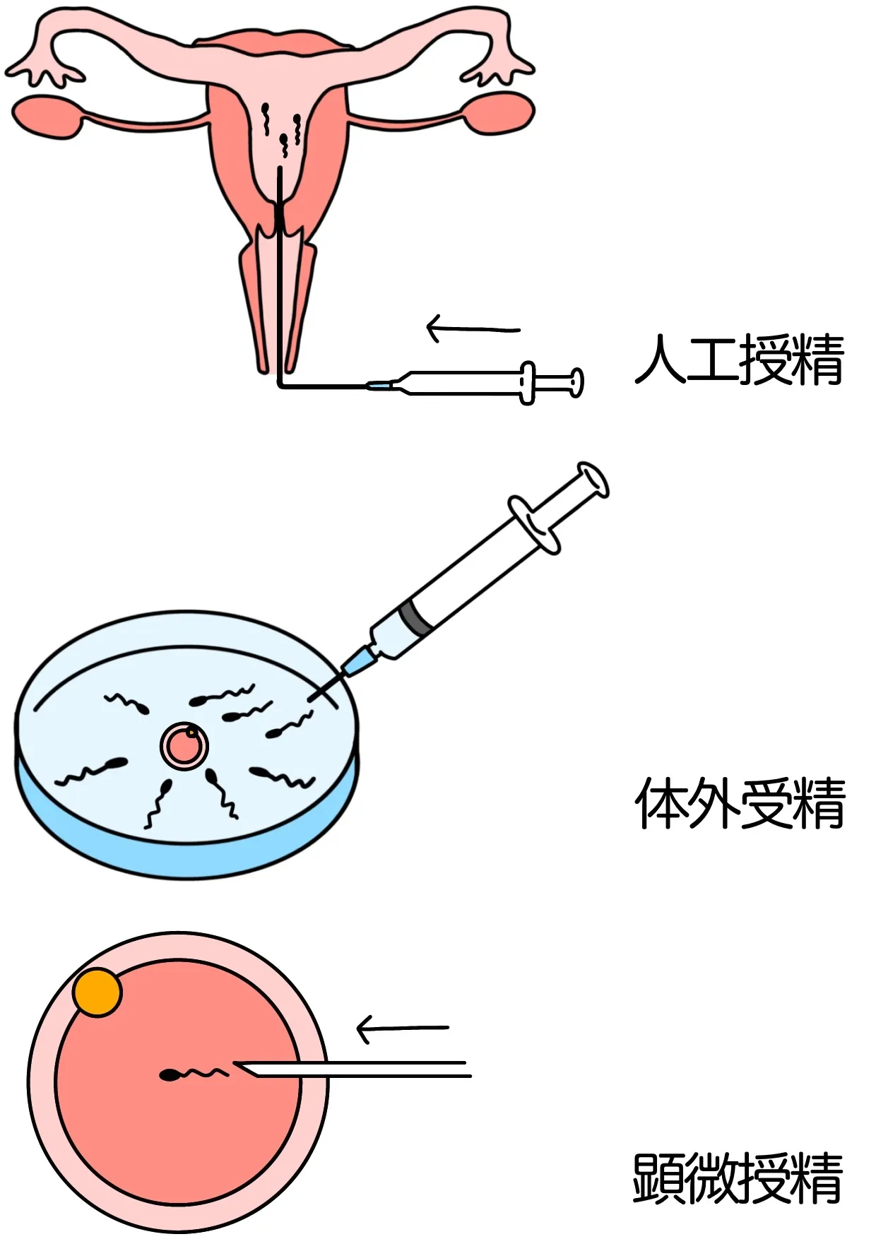 広島市の病院で提供される不妊治療